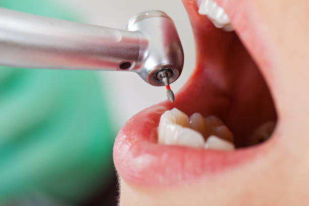 Best Root Canal Emergency Dentist  in North Arlington, NJ